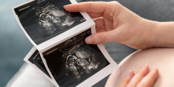 Die erste Ultraschalluntersuchung einer Schwangerschaft nach einer IVF-Behandlung