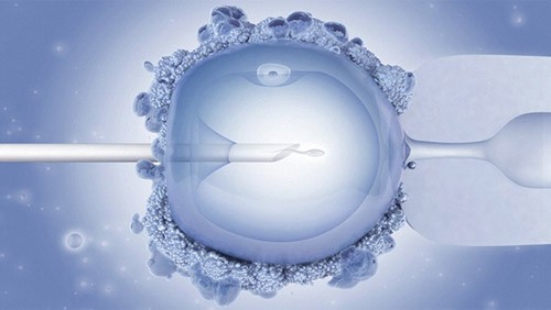 Fertility Treatments ICSI