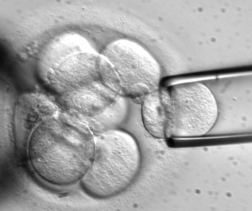 Fertility Treatments Preimplantation Genetic Testing
